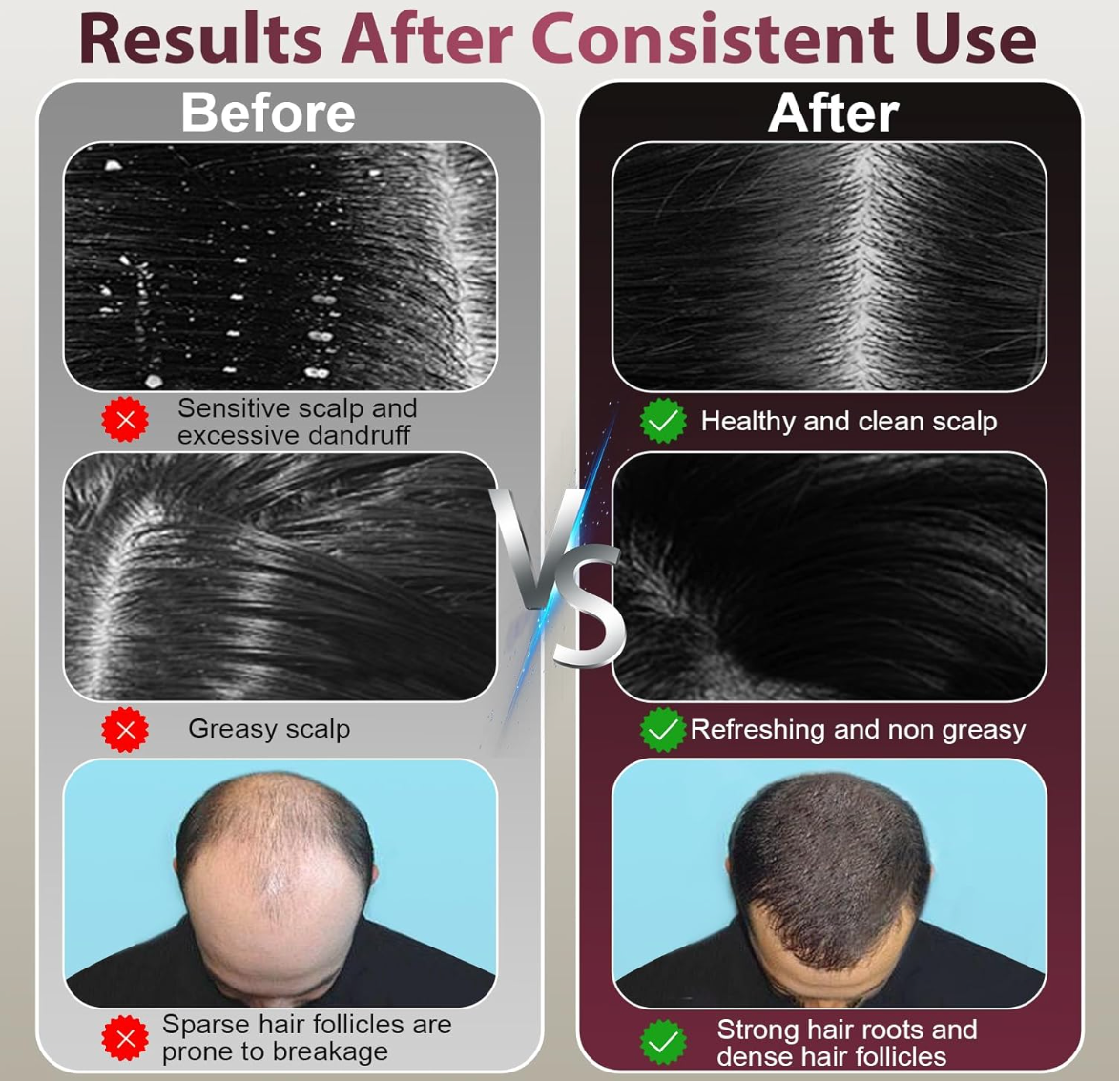 SHFTD™ Scalp Treatment System