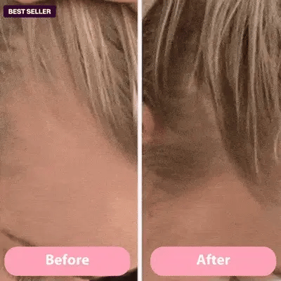 SHFTD™ Scalp Treatment System