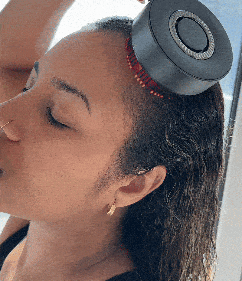 SHFTD™ Scalp Treatment System